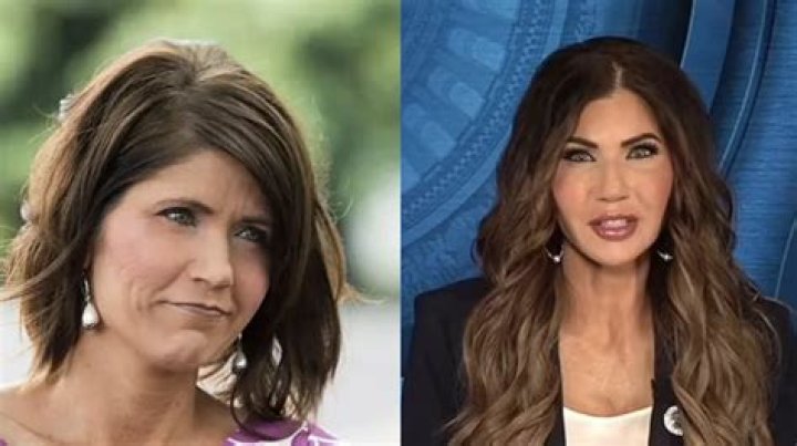 Nikki Haley's Plastic Surgery Journey